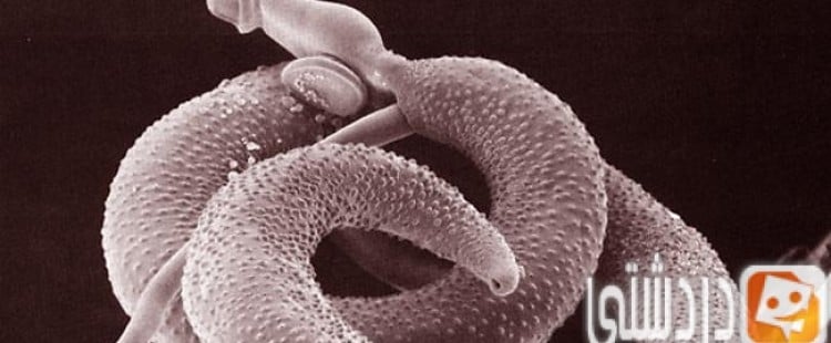 أعراض مرض البلهارسيا وعلاجه