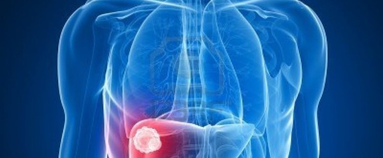 الكبد الوبائي أعراضه وكيفية الوقاية منه