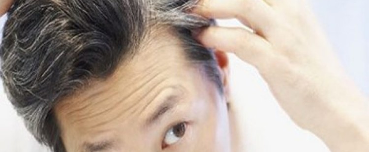 أسباب ظهور الشعر الأبيض في سن مبكر
