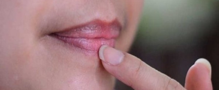 كيفية الوقاية من السواد حول الفم