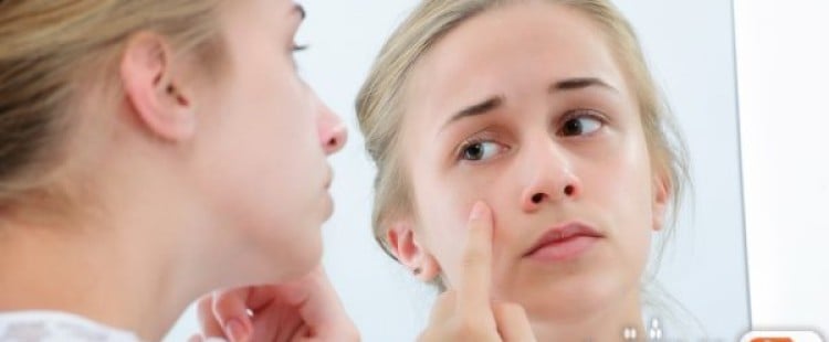 أسباب البقع البيضاء على الوجه