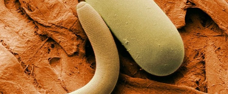 مشروبات تطهر البطن من الديدان