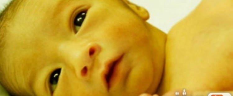 معلومات عن يرقان الرضع