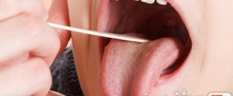 أعراض التهاب لسان المزمار وعلاجه