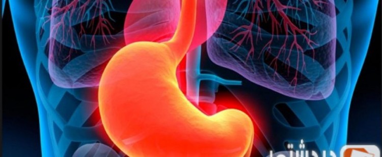 أسباب التهاب المعدة وعلاجها