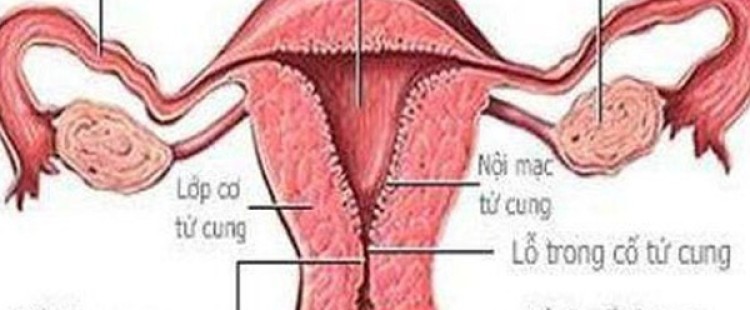 أعراض قصور عنق الرحم وعلاجه