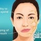 أعراض شلل العصب الوجهي وعلاجه