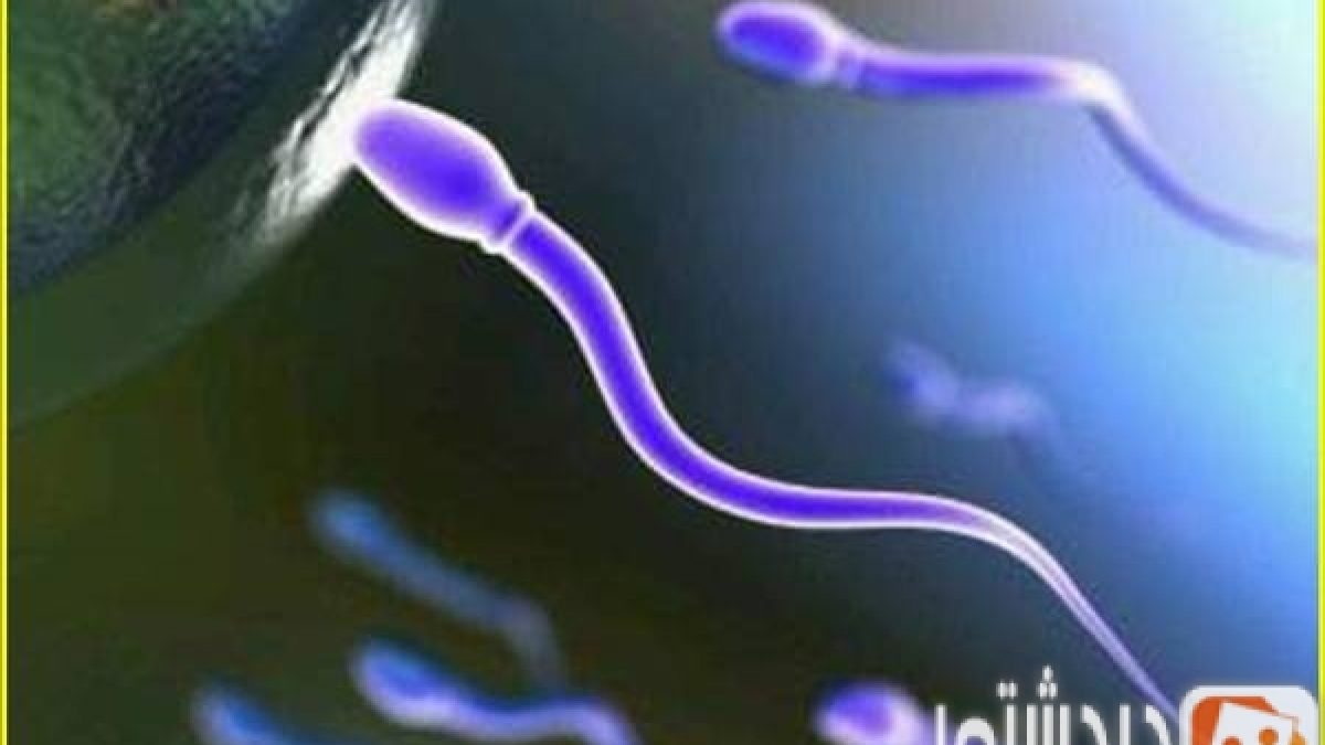 للرجال إعرف سبب تشوه الحيوانات المنوية وعالجها